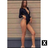 ANNA Escort in Dartford