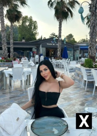 Gaziantep | Escort Masal-21-270019-photo-3