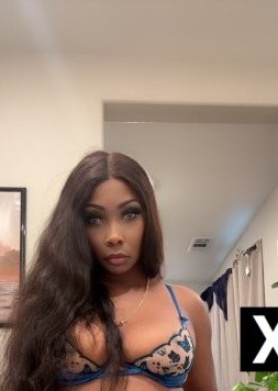 Irvine | Escort Skkyy-35-288102-photo-1